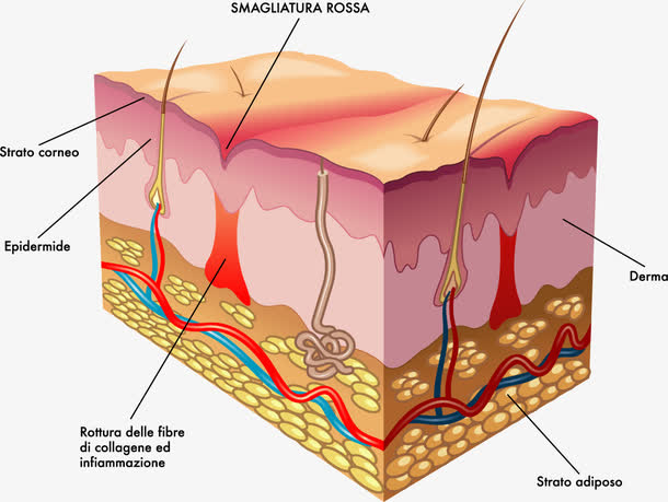皮膚的基本結(jié)構(gòu)