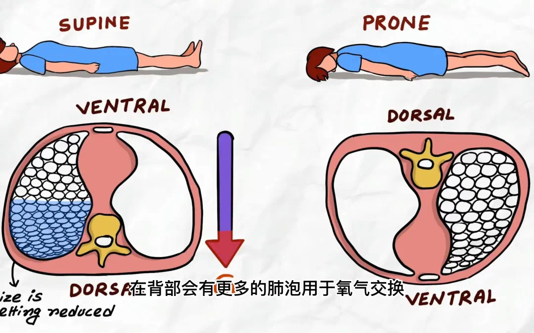 換個(gè)姿勢(shì)睡覺(jué)，竟然可以救命